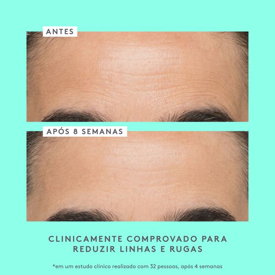 REVISITING THE CLASSICS KIT KIT PEPT�DEO